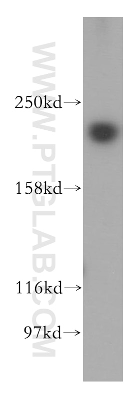 Western Blot (WB) analysis of HeLa cells using NuMA Polyclonal antibody (16607-1-AP)