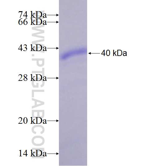 NUMA1 fusion protein Ag9815 SDS-PAGE