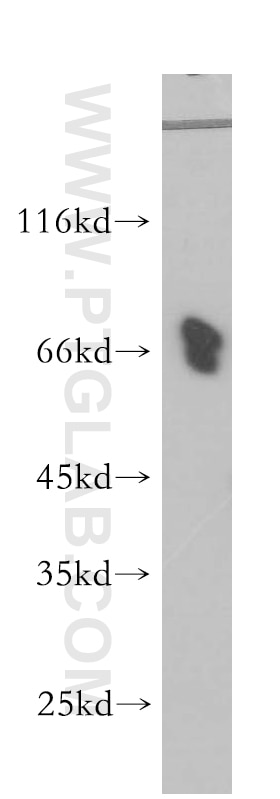 Western Blot (WB) analysis of HeLa cells using NUMB Polyclonal antibody (11876-1-AP)