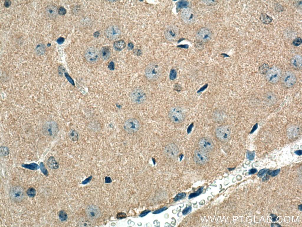 Immunohistochemistry (IHC) staining of mouse brain tissue using NUMB Polyclonal antibody (18701-1-AP)