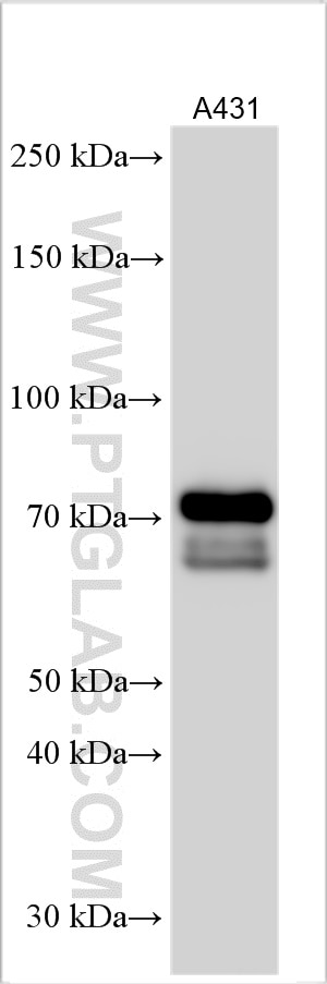 Western Blot (WB) analysis of various lysates using NUMB Polyclonal antibody (18701-1-AP)