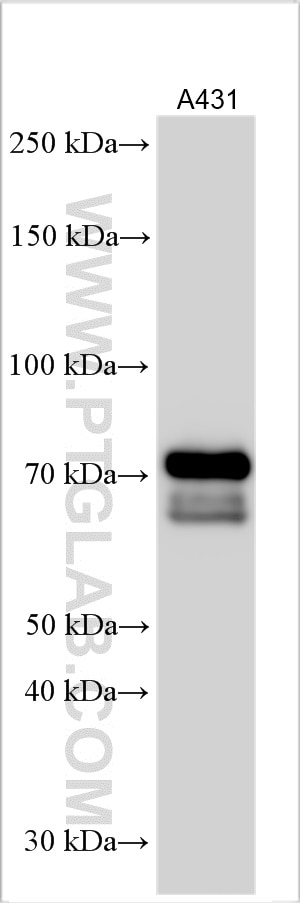 WB analysis using 18701-1-AP