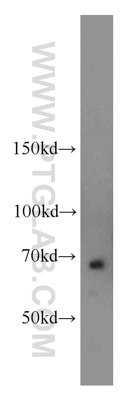 Western Blot (WB) analysis of mouse brain tissue using NUMB Polyclonal antibody (18701-1-AP)