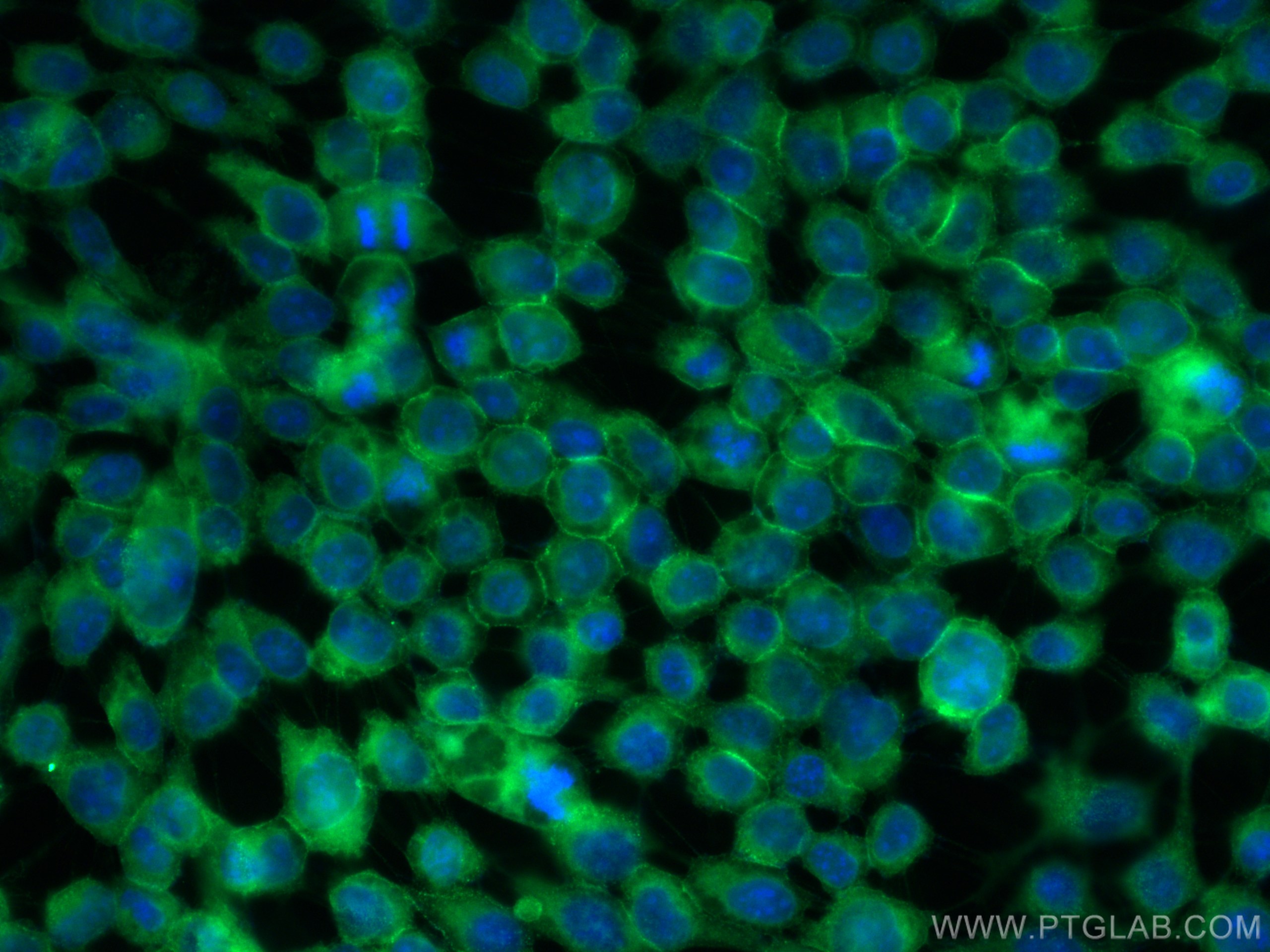 Immunofluorescence (IF) / fluorescent staining of A431 cells using NUMB Polyclonal antibody (29594-1-AP)