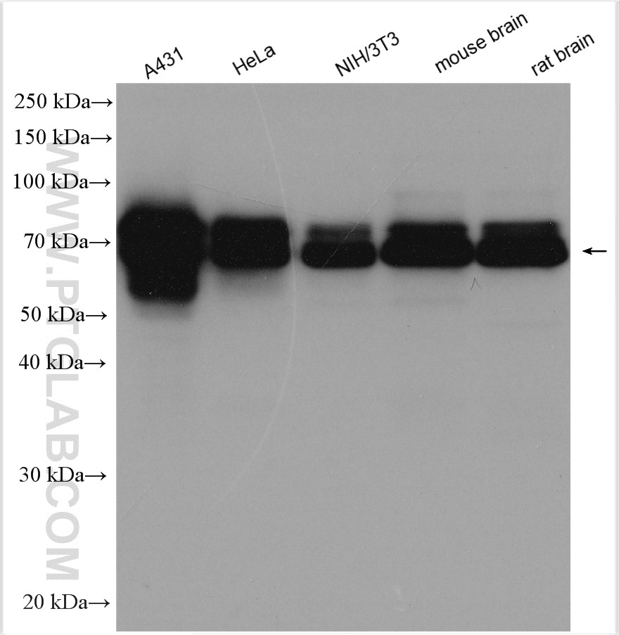 Western Blot (WB) analysis of various lysates using NUMB Polyclonal antibody (29594-1-AP)