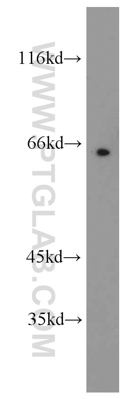 Western Blot (WB) analysis of mouse brain tissue using NUMB Polyclonal antibody (55321-1-AP)