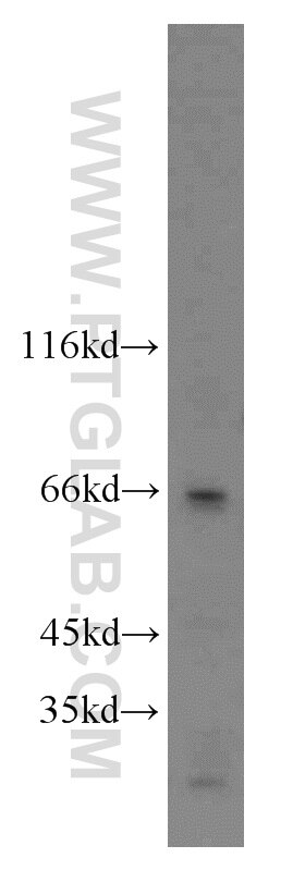 Western Blot (WB) analysis of mouse brain tissue using NUMB Polyclonal antibody (55321-1-AP)