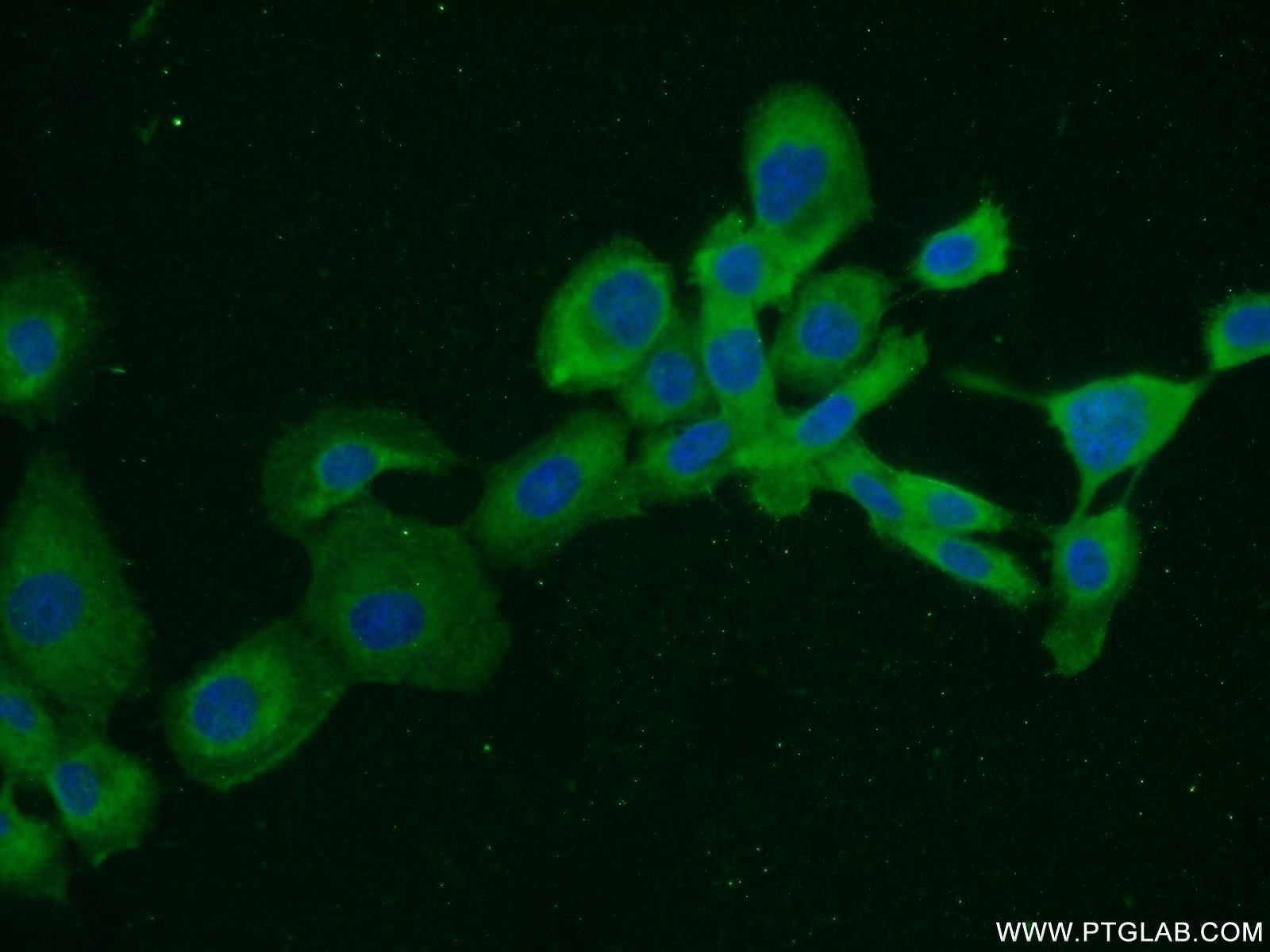 Immunofluorescence (IF) / fluorescent staining of A431 cells using NUMB Monoclonal antibody (60137-1-Ig)