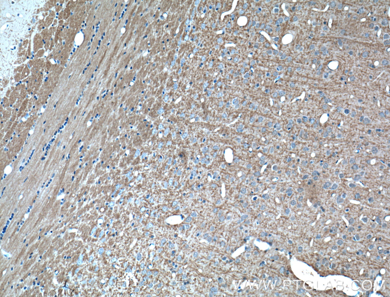 Immunohistochemistry (IHC) staining of rat brain tissue using NUMB Monoclonal antibody (60137-1-Ig)