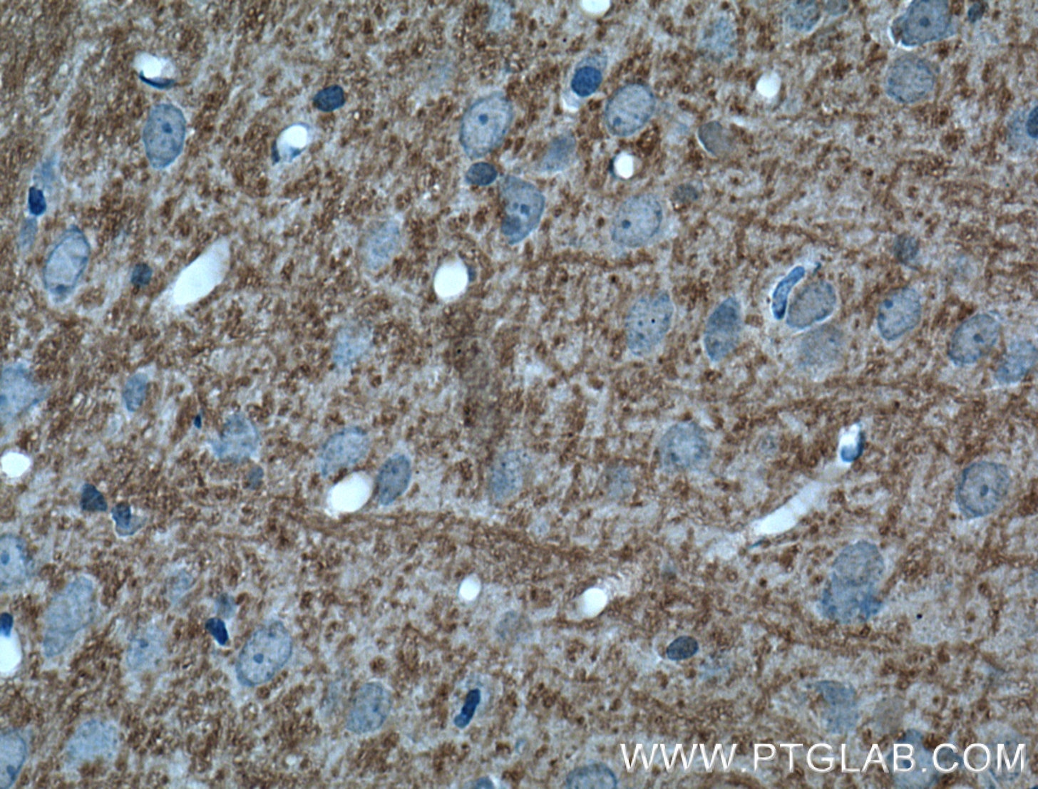 Immunohistochemistry (IHC) staining of rat brain tissue using NUMB Monoclonal antibody (60137-1-Ig)