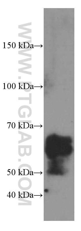 Western Blot (WB) analysis of U-251 cells using NUMB Monoclonal antibody (60137-1-Ig)