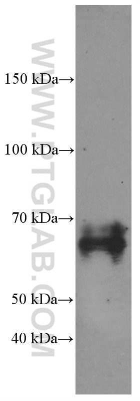 Western Blot (WB) analysis of A431 cells using NUMB Monoclonal antibody (60137-1-Ig)