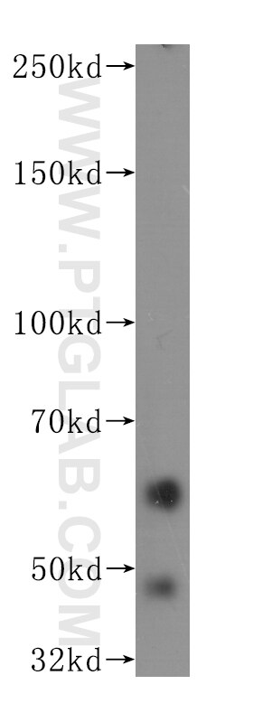 Western Blot (WB) analysis of human brain tissue using NUMB Monoclonal antibody (60137-1-Ig)