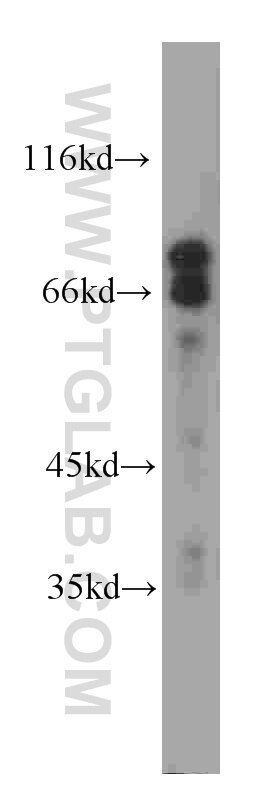 Western Blot (WB) analysis of A431 cells using NUMB Monoclonal antibody (60137-2-Ig)