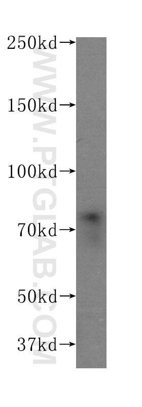 Western Blot (WB) analysis of A431 cells using NUMB Monoclonal antibody (60137-2-Ig)