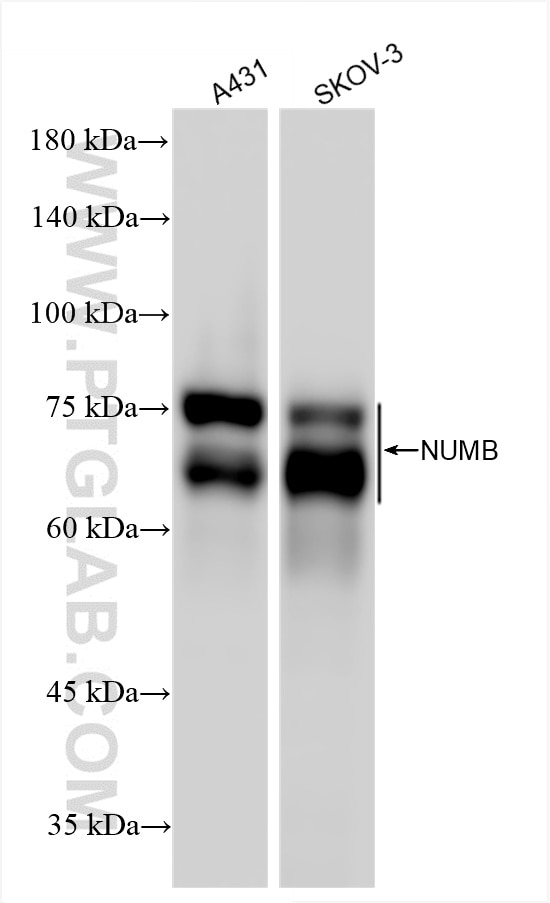 Western Blot (WB) analysis of various lysates using NUMB Recombinant antibody (85939-4-RR)