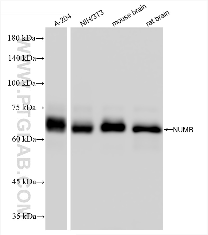 Western Blot (WB) analysis of various lysates using NUMB Recombinant antibody (85939-4-RR)