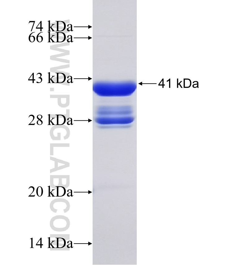 NUMB fusion protein Ag31553 SDS-PAGE