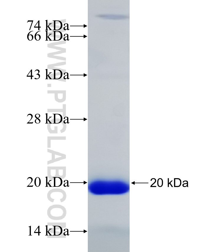 NUMB fusion protein Ag31562 SDS-PAGE