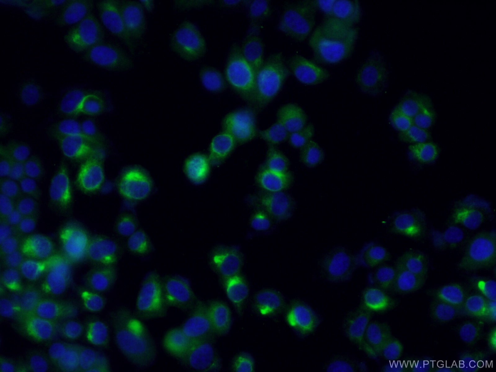Immunofluorescence (IF) / fluorescent staining of PC-12 cells using NUMBL Polyclonal antibody (10111-1-AP)