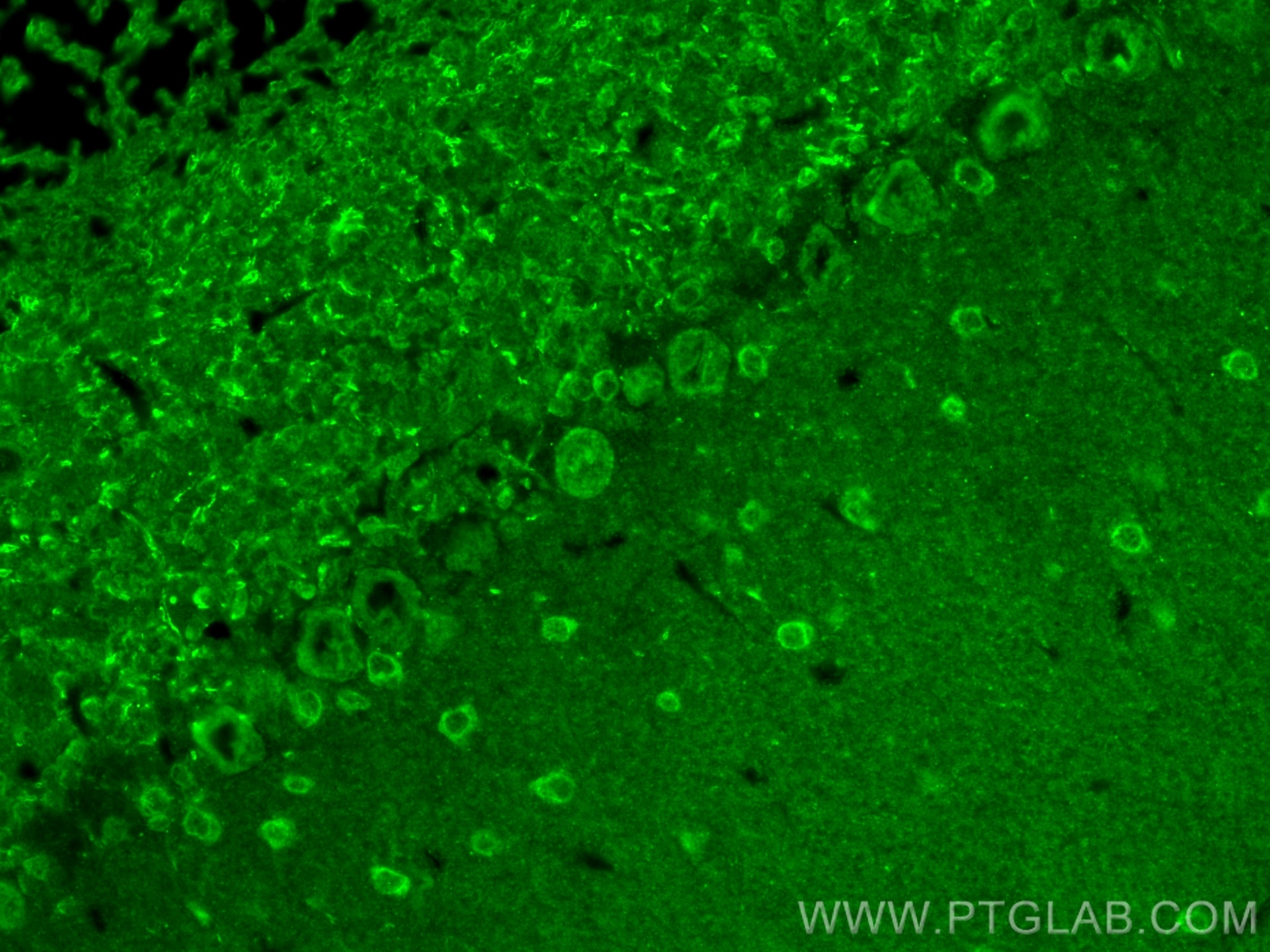 Immunofluorescence (IF) / fluorescent staining of mouse cerebellum tissue using NUMBL Polyclonal antibody (10111-1-AP)