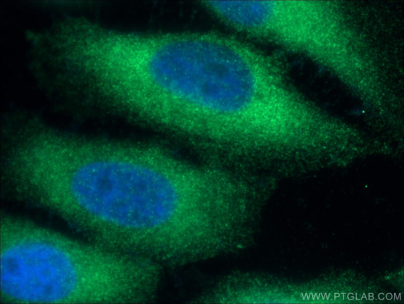 Immunofluorescence (IF) / fluorescent staining of HepG2 cells using NUMBL Polyclonal antibody (10111-1-AP)