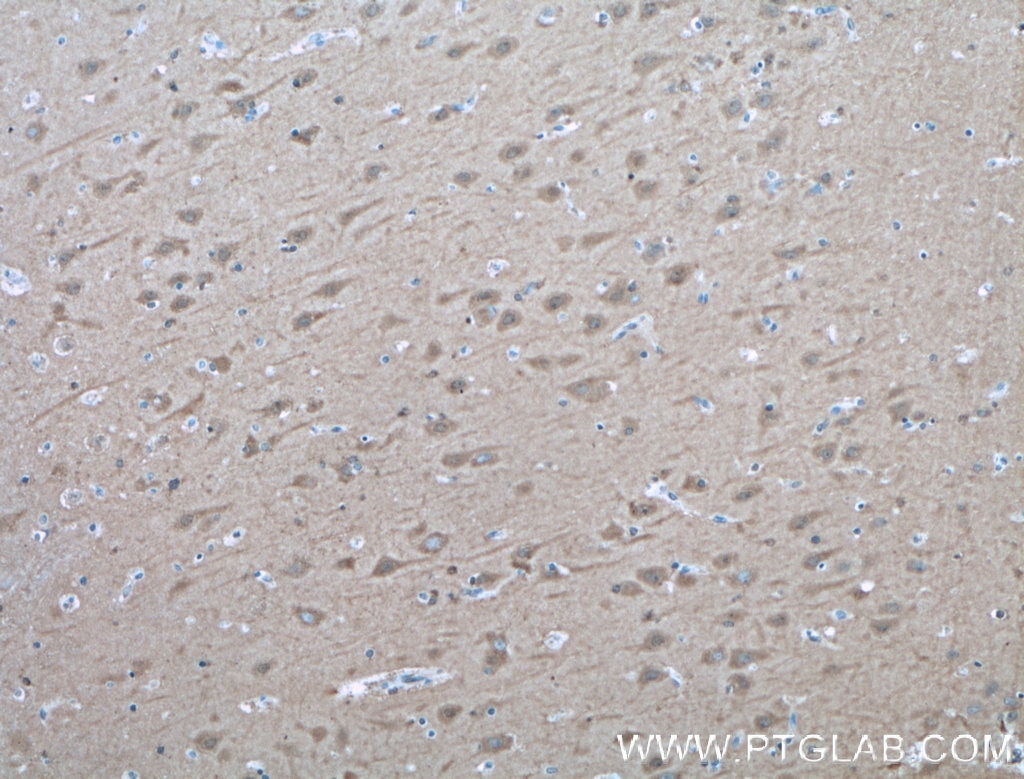 Immunohistochemistry (IHC) staining of human brain tissue using NUMBL Polyclonal antibody (10111-1-AP)