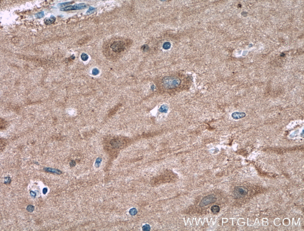 Immunohistochemistry (IHC) staining of human brain tissue using NUMBL Polyclonal antibody (10111-1-AP)