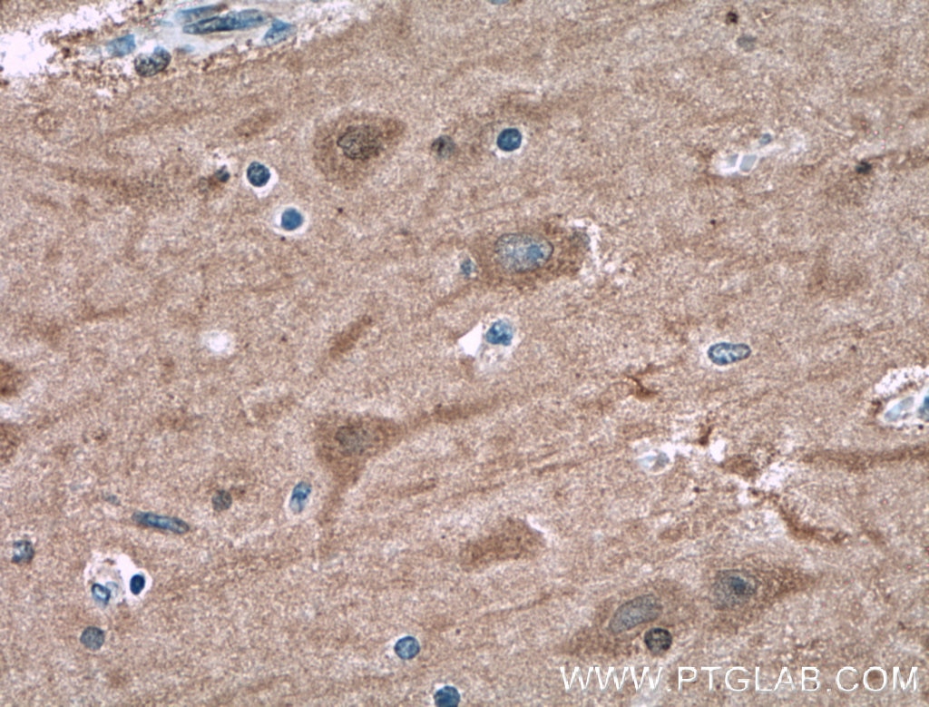 IHC staining of human brain using 10111-1-AP