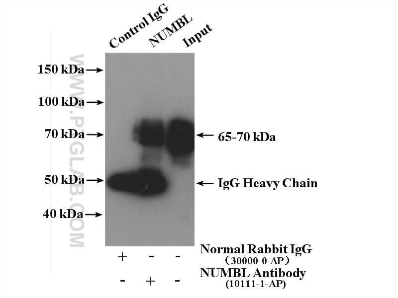 Immunoprecipitation (IP) experiment of HeLa cells using NUMBL Polyclonal antibody (10111-1-AP)