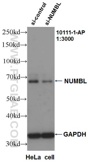 Western Blot (WB) analysis of HeLa cells using NUMBL Polyclonal antibody (10111-1-AP)