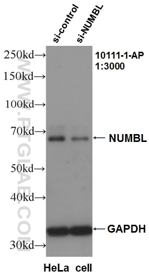 WB analysis of HeLa using 10111-1-AP