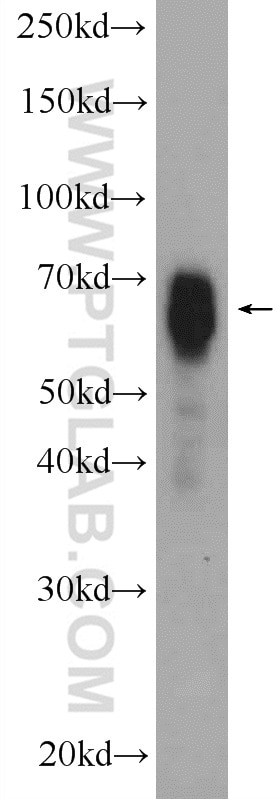 Western Blot (WB) analysis of mouse brain tissue using NUMBL Polyclonal antibody (10111-1-AP)