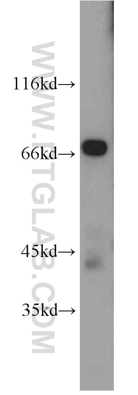 Western Blot (WB) analysis of mouse spleen tissue using NUMBL Polyclonal antibody (10111-1-AP)