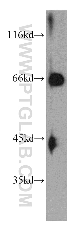 Western Blot (WB) analysis of mouse lung tissue using NUMBL Polyclonal antibody (10111-1-AP)