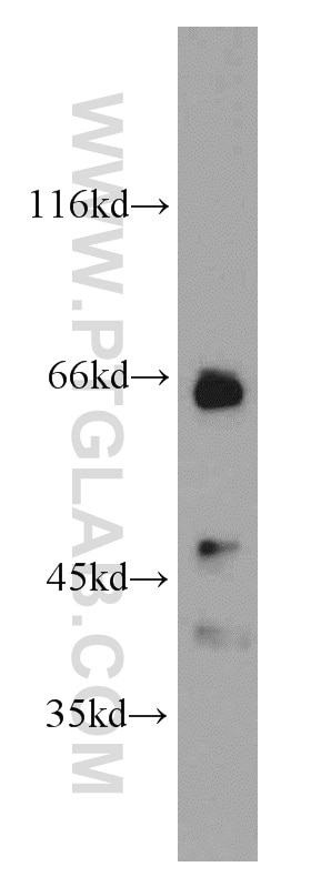 Western Blot (WB) analysis of mouse liver tissue using NUMBL Polyclonal antibody (10111-1-AP)