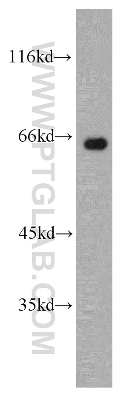 Western Blot (WB) analysis of HeLa cells using NUMBL Polyclonal antibody (10111-1-AP)