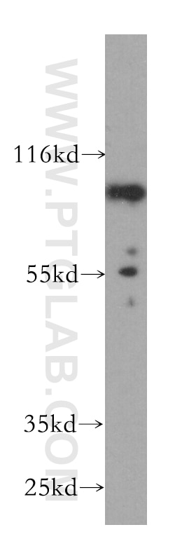 Western Blot (WB) analysis of HepG2 cells using NUMBL Monoclonal antibody (60009-1-Ig)