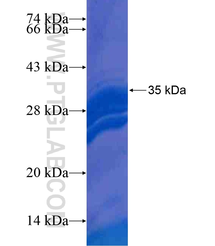 NUMBL fusion protein Ag17935 SDS-PAGE
