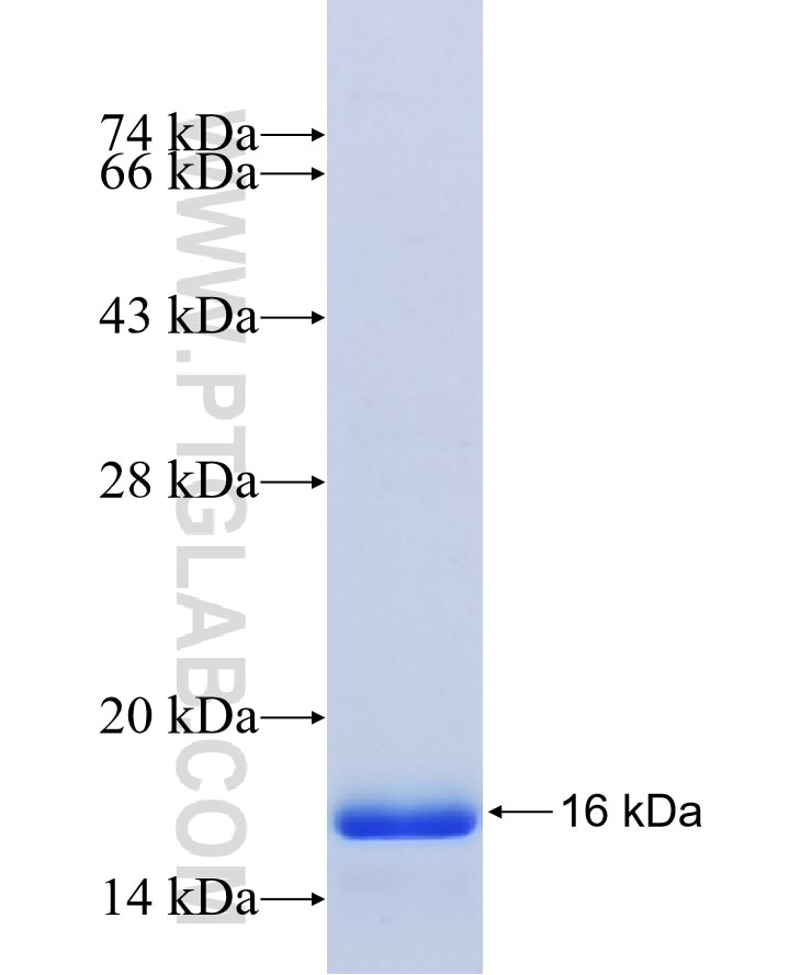 NUMBL fusion protein Ag18177 SDS-PAGE