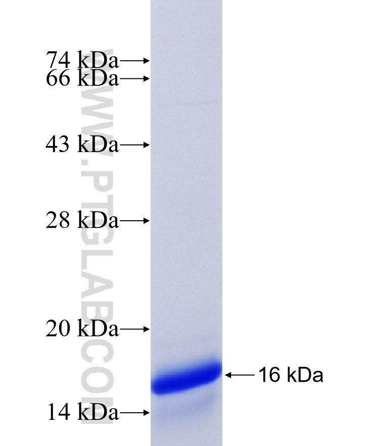 NUMBL fusion protein Ag18177 SDS-PAGE