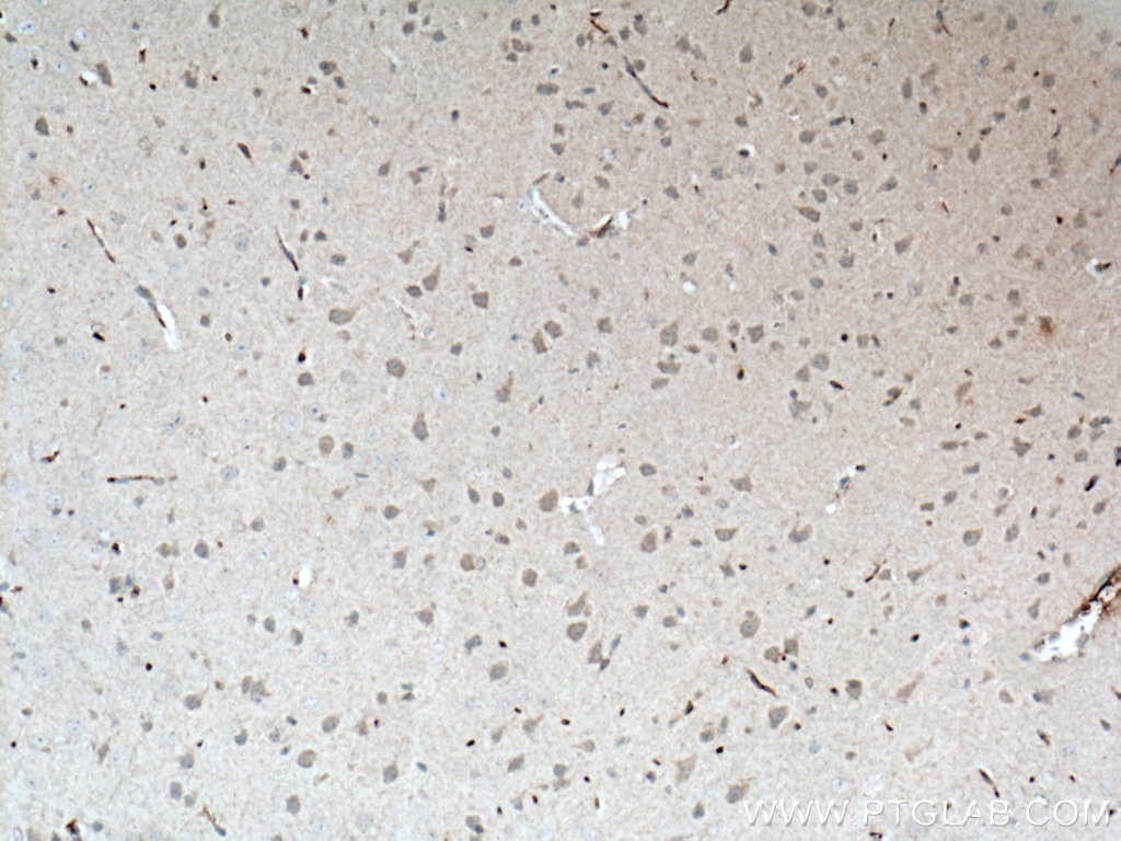 IHC staining of mouse brain using 66155-1-Ig
