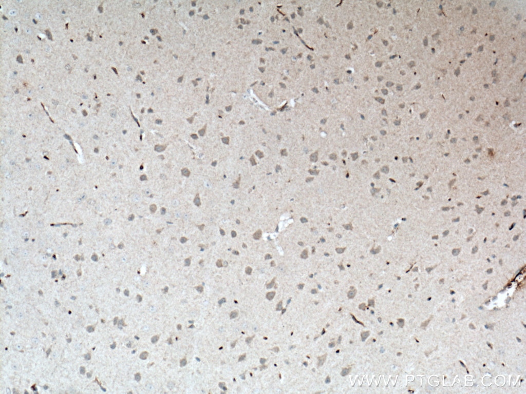 Immunohistochemistry (IHC) staining of mouse brain tissue using NUMBL Monoclonal antibody (66155-1-Ig)