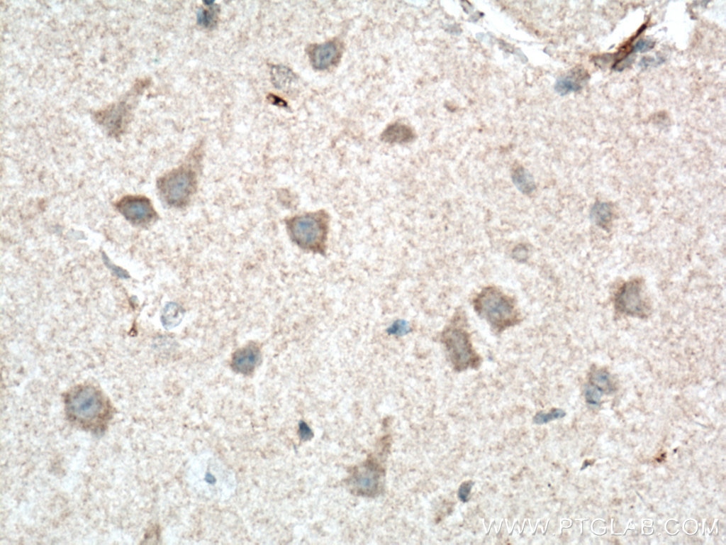 Immunohistochemistry (IHC) staining of mouse brain tissue using NUMBL Monoclonal antibody (66155-1-Ig)