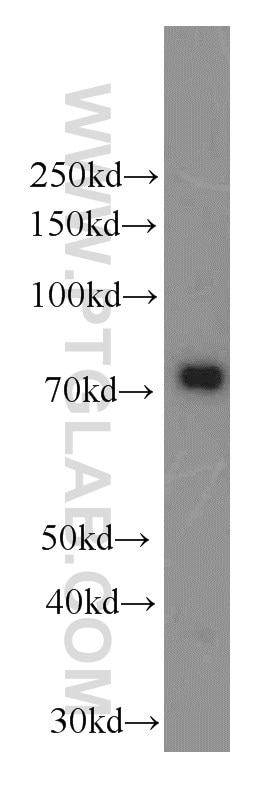 Western Blot (WB) analysis of L02 cells using NUMBL Monoclonal antibody (66155-1-Ig)