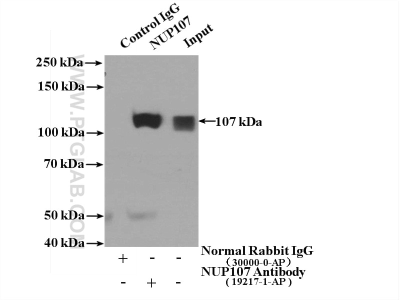 Immunoprecipitation (IP) experiment of HeLa cells using NUP107 Polyclonal antibody (19217-1-AP)
