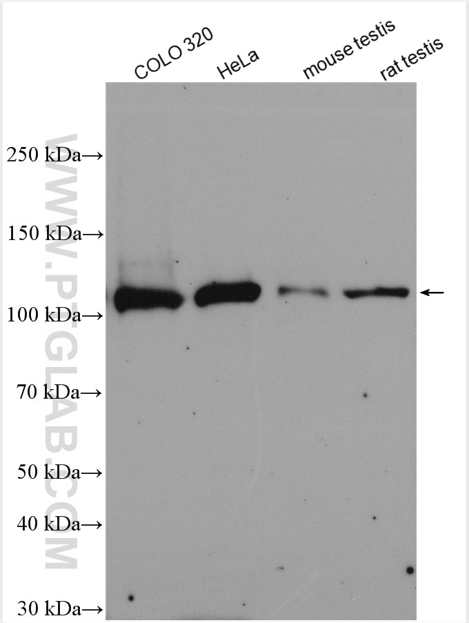 Western Blot (WB) analysis of various lysates using NUP107 Polyclonal antibody (19217-1-AP)