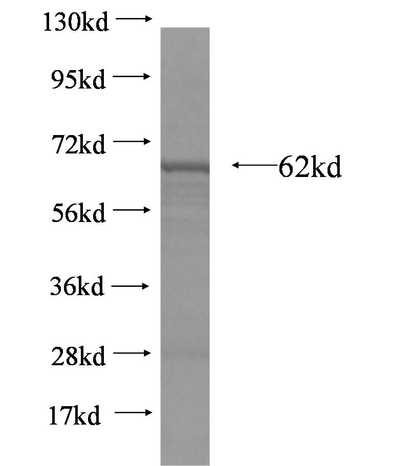 NUP107 fusion protein Ag5251 SDS-PAGE