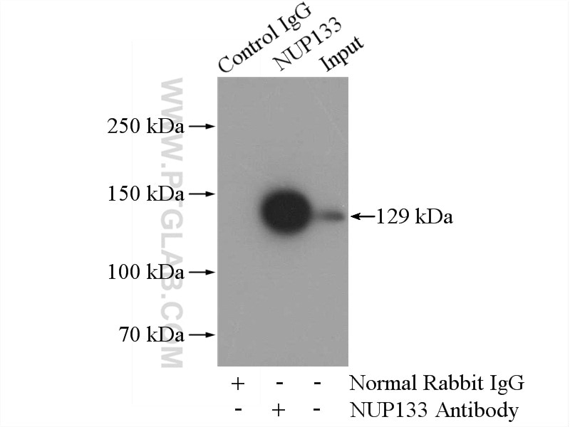 Immunoprecipitation (IP) experiment of HeLa cells using NUP133 Polyclonal antibody (12405-1-AP)