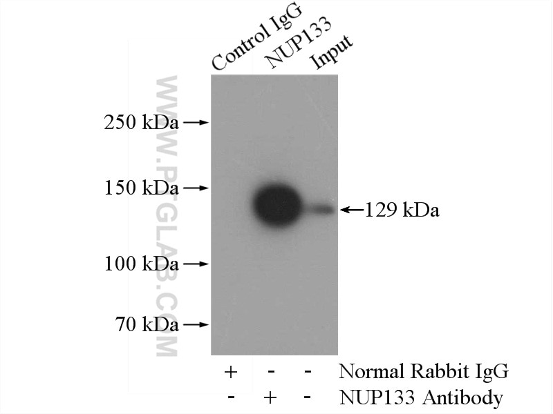 IP experiment of HeLa using 12405-1-AP